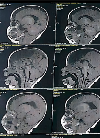 Imágenes de resonancia magnética compartidas para la campaña de Alejandro